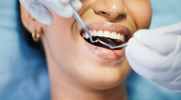 Best Emergency Cosmetic Dentistry in Cecilia, LA