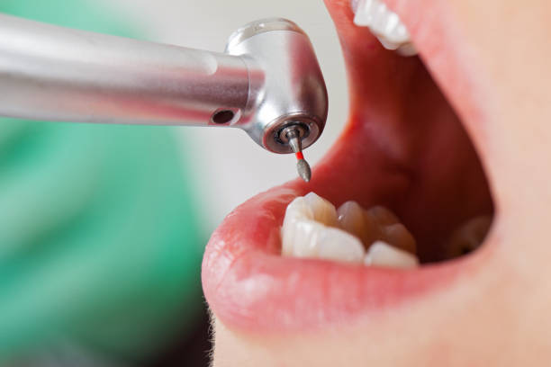 Best Emergency Dental Care for Abscessed Tooth in Cecilia, LA